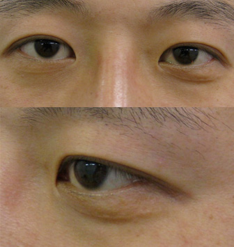 手術前